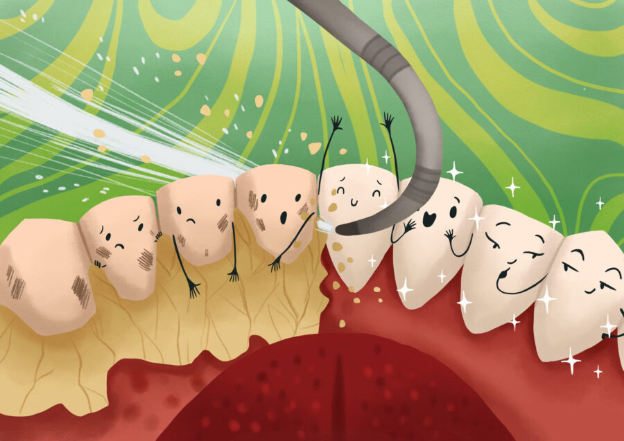 deep cleaning for gum disease and bleeding gums, periodontal care